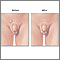 Before and after testicular repair